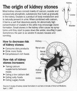 Kidney Stone