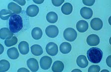 E. Lymphocytes 
 
Link to ... 
Blood Cells and the CBC
Ed Uthman, MD 
Diplomate, American Board of Pathology 