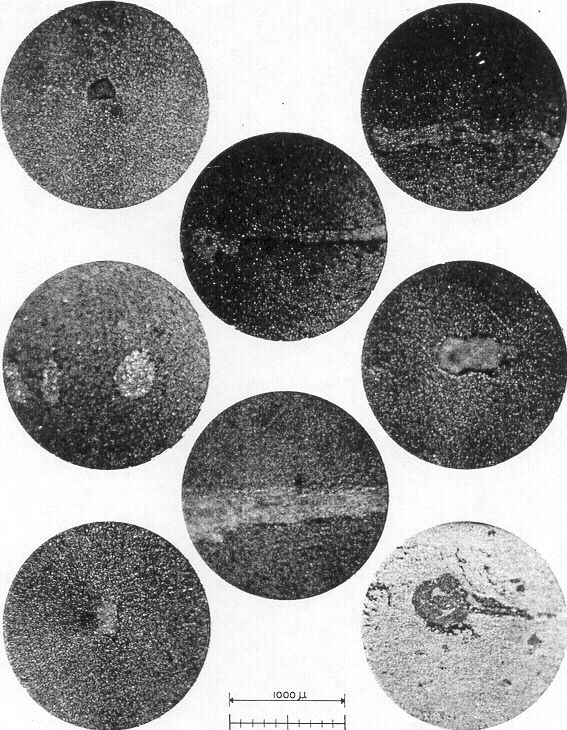 Figure 82 
 
Photomicrographs of whole blood for transfusion 