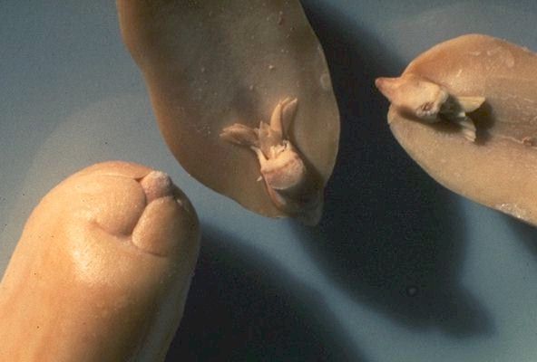 Peanut Germ
 
Click on Picture for a Slide Show. 