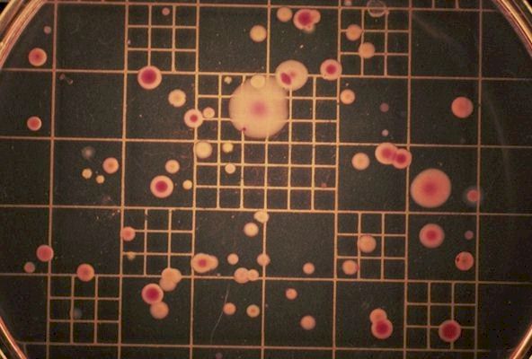 Each colony represents 1,000,000 bacteria.  Remember, the dilution was 1 in 1,000,000.
 
Click on Picture for Next Slide. 