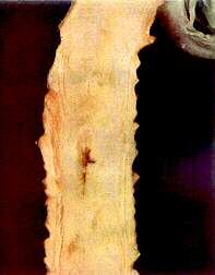 Cabbage Stem (Savoy) - Boron deficiency 