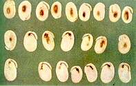 Haricot Bean Seeds - Manganese deficiency 