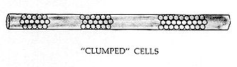 Figure 177 - CLUMPED CELLS 